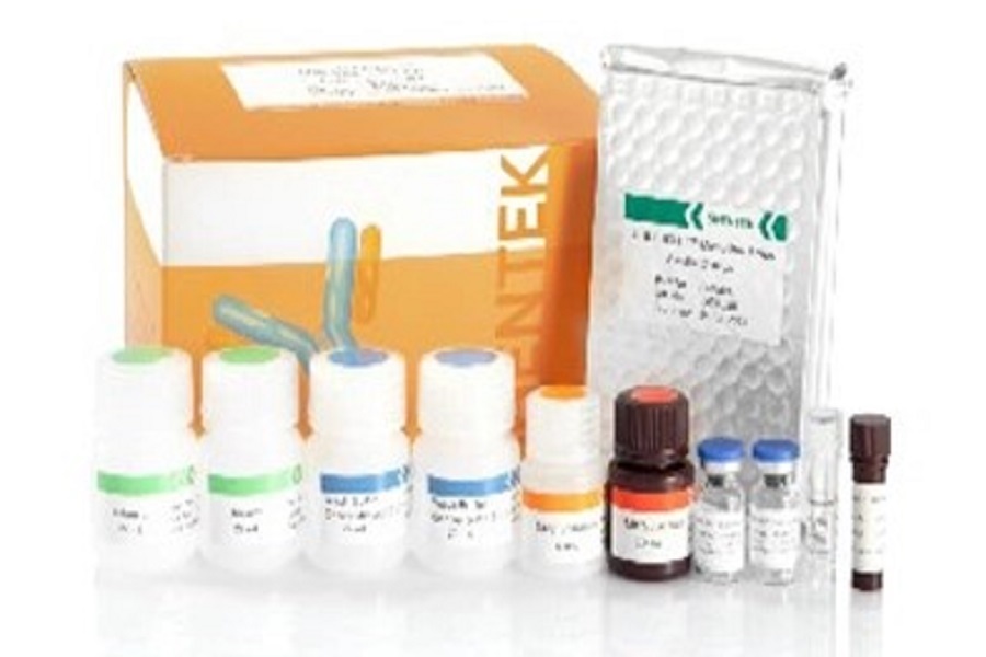 Die Bedeutung und Methoden der Protein analyze von Rest wirts zellen